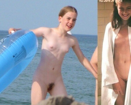 Bare Lake Days photos - Physical freedom is important to many nudists
